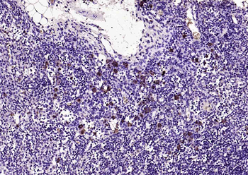 CCR7 Rabbit Polyclonal Antibody