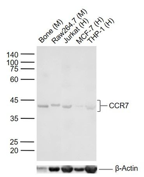 CCR7 Rabbit Polyclonal Antibody