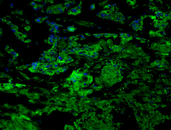 CCR7 Rabbit Polyclonal Antibody