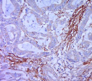 Syndecan-1 Rabbit Polyclonal Antibody