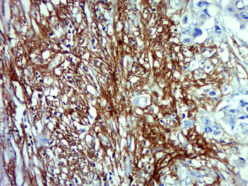 Syndecan-1 Rabbit Polyclonal Antibody
