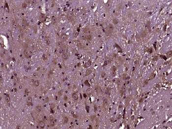 CD147 Rabbit Polyclonal Antibody