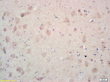 DDR1 Rabbit Polyclonal Antibody