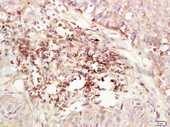 CXCR4 Rabbit Polyclonal Antibody