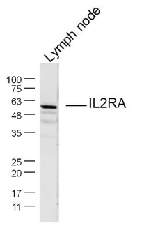 IL2RA/CD25 Rabbit Polyclonal Antibody