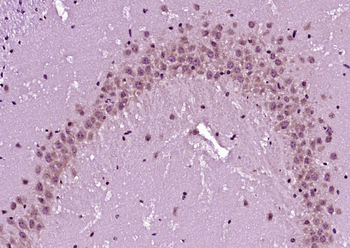 CD2AP Rabbit Polyclonal Antibody