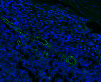 CD31 Rabbit Polyclonal Antibody
