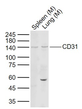 CD31 Rabbit Polyclonal Antibody