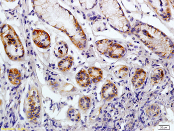 CD38 Rabbit Polyclonal Antibody