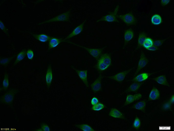 CD56 Rabbit Polyclonal Antibody