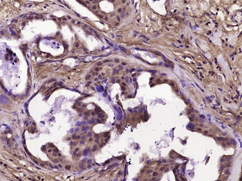 CDK1 Rabbit Polyclonal Antibody