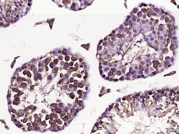 CDK1 Rabbit Polyclonal Antibody