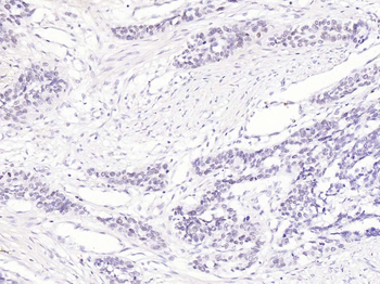 CDK1 Rabbit Polyclonal Antibody