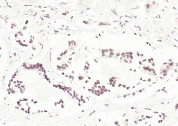 CDK4 Rabbit Polyclonal Antibody