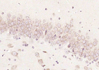 CDK4 Rabbit Polyclonal Antibody