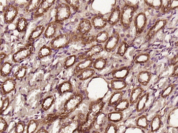 CDK4 Rabbit Polyclonal Antibody