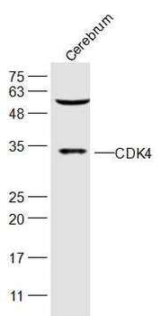 CDK4 Rabbit Polyclonal Antibody