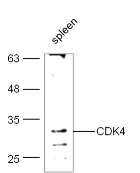 CDK4 Rabbit Polyclonal Antibody