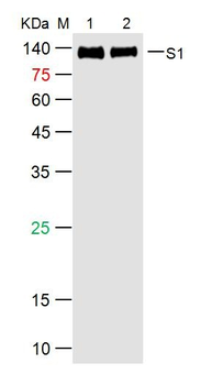 SARS-CoV-2 (2019-nCoV) Spike S1 Mouse Monoclonal Antibody