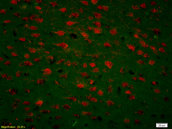 CDK5 Rabbit Polyclonal Antibody