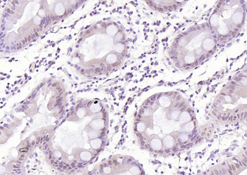 CDK6 Rabbit Polyclonal Antibody