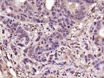 CDK6 Rabbit Polyclonal Antibody