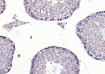 CDK6 Rabbit Polyclonal Antibody