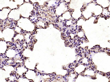 CDK6 Rabbit Polyclonal Antibody