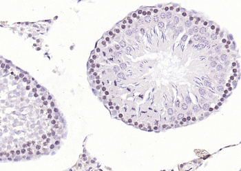 CDK6 Rabbit Polyclonal Antibody