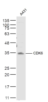 CDK6 Rabbit Polyclonal Antibody