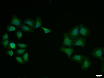 CDK7 Rabbit Polyclonal Antibody