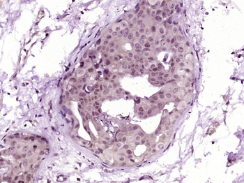 CDK7 Rabbit Polyclonal Antibody