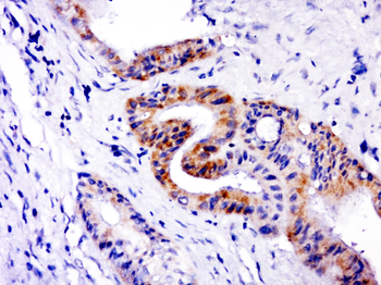 CDK7 Rabbit Polyclonal Antibody