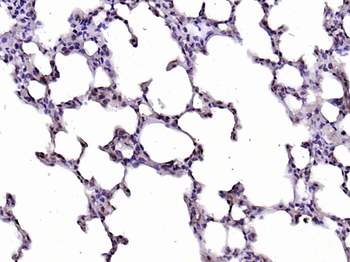CDK7 Rabbit Polyclonal Antibody
