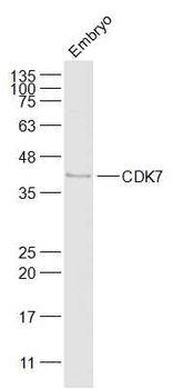 CDK7 Rabbit Polyclonal Antibody