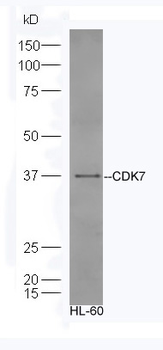 CDK7 Rabbit Polyclonal Antibody