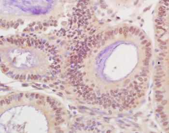 CDK8 Rabbit Polyclonal Antibody