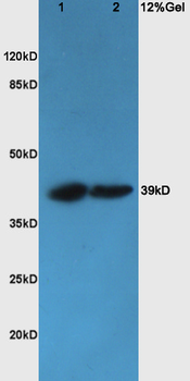 CHI3L1 Rabbit Polyclonal Antibody