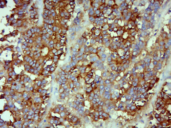 CEA (C3) Mouse Monoclonal Antibody