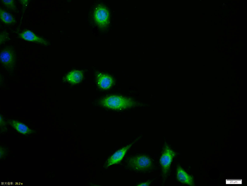 ERBB2/HER2 Rabbit Polyclonal Antibody