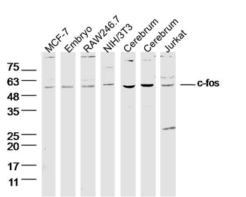 C-fos Rabbit Polyclonal Antibody