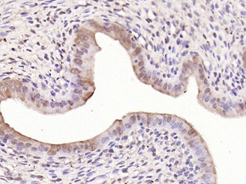 C-fos Rabbit Polyclonal Antibody