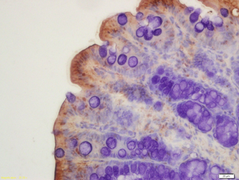 CFTR Rabbit Polyclonal Antibody