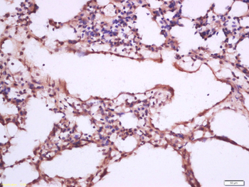 CFTR Rabbit Polyclonal Antibody