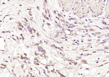 CHGA Rabbit Polyclonal Antibody