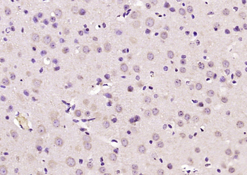 CHGA Rabbit Polyclonal Antibody