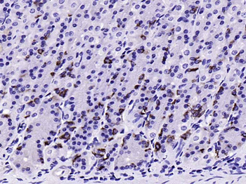 CHGA Rabbit Polyclonal Antibody