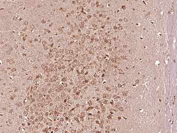 ChAT Rabbit Polyclonal Antibody