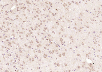 ChAT Rabbit Polyclonal Antibody