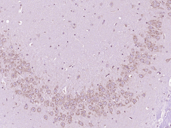 ChAT Rabbit Polyclonal Antibody